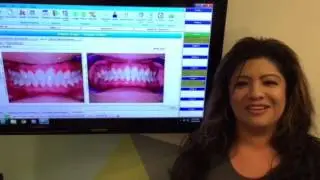 Mesa Orthodontist Invisalign Treatment Adult Patient