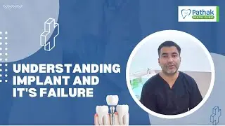 Dental Implant in Pune: Avoid Implant Failures &ndash; Expert Advice from Best Dentist in Pune