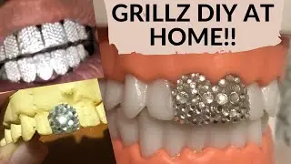 GRILLZ DIY At Home! The PERFECT Tooth gem Removable Veneers, Fun and Easy