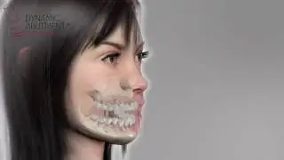 Dynamic &mu;scanbody