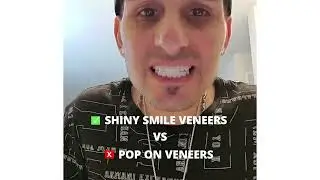 ⭐ Shiny Smile Veneers vs Pop On Veneers: An Honest Review!