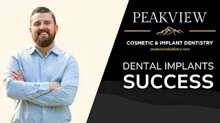 Factors for Dental Implants Success With Dr. Kwiatkowski
