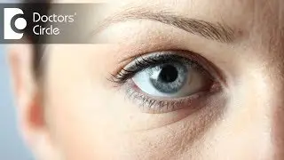 What causes dark spots in the white part of eyes? - Dr. Elankumaran P