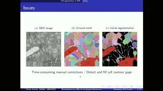 AI Segmentation and Image Quantification by Florian Robert - 12th talk at the vEM Technology Forum