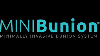 MINIBunion: MIS Bunion System FAQ - 