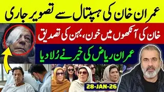 Imran Khan Hospital Photo Goes Viral | Suffering from Dangerous Eye Disease | Imran Riaz Khan VLOG