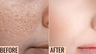 Optimals comforting facial Toner with Vitamin B3 + B5 from Oat + Panthenol Oriflame