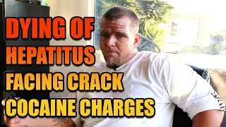Hepatitus B was killing him & he was facing Crack Cocaine charges - Owen Culpepper