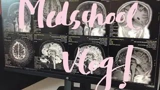 Frpmc diaries|Ep-04|Med school vlog as a 2nd year Pakistani student |