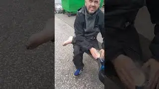 rotten foot guy nasty #newvideo #youtubeshorts