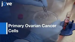 Primary Ovarian Cancer Cells from Solid Specimens | Protocol Preview