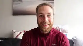 21 WEEK UPDATE FUE HAIR TRANSPLANT ISTANBUL TURKEY