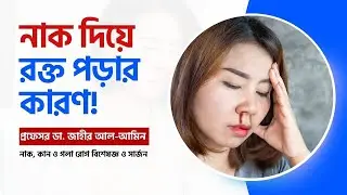 নাক দিয়ে রক্ত পড়ার কারণ ও এর চিকিৎসা II Nose bleeds causes and treatment