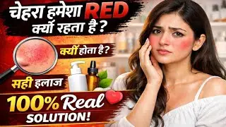 Ghar Baithe Skin Redness Kaise Kam Karein? 🔴 Complete Guide in Hindi