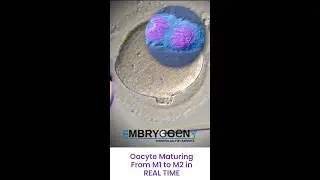 Oocyte Maturation from M1 to M2 in Real Time - Watch the Molecular Masterpiece Under Microscope