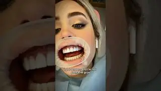 БЕСПЛАТНЫЕ ВИНИРЫ?!