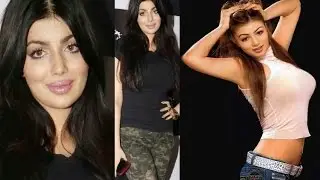 11 Bollywood Plastic Surgeries that Horribly Went Wrong