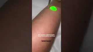 Warum funktioniert Laser Haarentfernung?