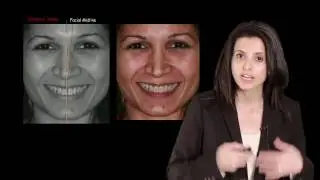 174-00 Aesthetic Treatment Planning - The Smile Design PREVIEW