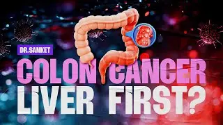 Why Liver Surgery Sometimes Comes Before Colon Surgery| Colon Cancer with Liver Metastases Explained