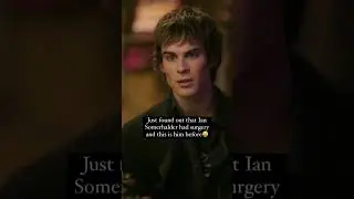 Ian Somerhalder before & after surgery #iansomerhalder #youtubeshorts #shorts