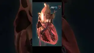 🫀🩸 Impella RP Heart Pump 🩸🫀