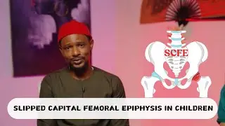 ALL YOU NEED TO KNOW ABOUT SCFE- SLIPPED CAPITAL FEMORAL EPIPHYSIS IN CHILDREN| PEDIATRICS -TO GO