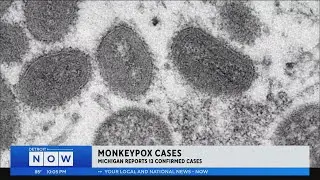 CDC: 13 Monkeypox Cases Reported In Michigan