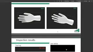 Vision Inspection Machine Glove Defect