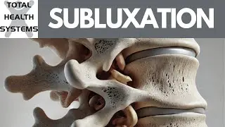 What Is A Subluxation?