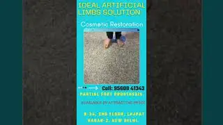 Nakli Tangl l Nakli Per l ArtificialLeg l best artificial limb clinic in india l