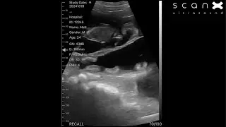 ScanX Air footage from pregnant dairy and Boer goats
