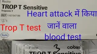 tropnin T test procedure / troponin t test method /Trop t test for heart attack