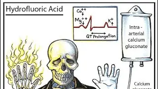 SERI B&Iacute; ẨN HO&Aacute; HỌC_ xử l&yacute; khi nhiễm độc Hydrofluoric Acid Ho&aacute; 10