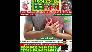 🌿 Real Proof: 38% से 67% Heart Recovery | बिना स्टेंट, बिना सर्जरी | Al Kabir Herbs Result