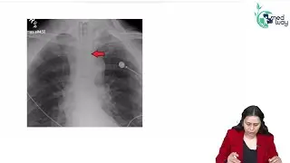Advanced Airway || Anaesthesia || By Dr. Swati Singh 🔥🔥 #anesthisa #medway