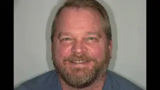 Jason's Testimonial | 3 on 6 Dental Implants