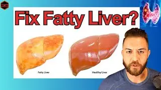 Thyroid Hormones: The Key to Reversing Fatty Liver?