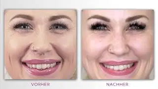 Dr. Isabell Sick: Nasenkorrektur, Botox, Skinbooster