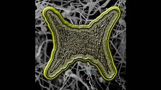 Thermoactinomyces Candidus - A Disgusting Amalgamation Of Pathologies [VOMITNOISE FULL ALBUM 2020]