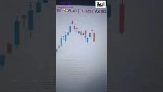 Trader 🤑😱 | #stockmarketshorts #shorts #viral #youtubeshorts