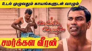 மனைவியால் ஒதுக்கப்பட்டு உடல் முழுவதும் காயங்களுடன் வாழும் சமர்க்கள வீரன் | En Iname En Saname EPI 74