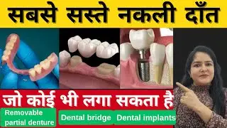 नकली दांत लगवाने के 3 प्रकार व खर्च | Missing teeth replacement|Artificial teeth fixing