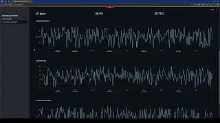IoT Diabetic Cardiovascular Health Monitoring Streamlit App