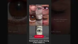 Check the sound to explore all of these weird eyes