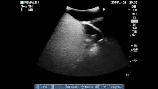 Adult Female Heart Phantom: Liver and Diaphragm motion