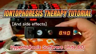 Step-By-Step Guide to Using Iontophoresis Therapy for Hyperhidrosis in BANGLA