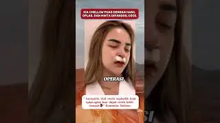Artis Icha Chellow setelah oplas kayak amanda manopo #ichachellow #fyp #soundhoreg #viral #trending