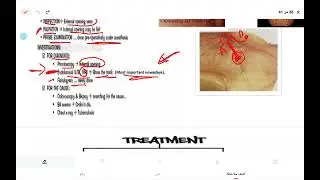 Disorders of colon,rectum and anal canal 4 KS
