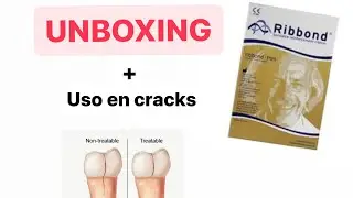 Ribbond- Unboxing + Ficha técnica